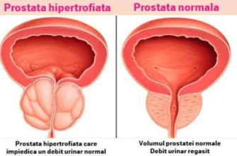 topform prostate - Srbija - gde kupiti - upotreba - forum - u apotekama - iskustva - komentari - cena